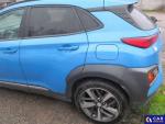 Hyundai Kona 1.6 T-GDI MR`18 E6d Aukcja 277651 - grafika 3