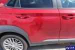 Hyundai Kona 1.6 T-GDI MR`18 E6d Aukcja 314037 - grafika 17