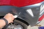 Hyundai Kona 1.6 T-GDI MR`18 E6d Aukcja 314037 - grafika 20