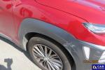 Hyundai Kona 1.6 T-GDI MR`18 E6d Aukcja 314037 - grafika 22