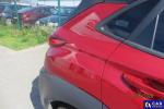 Hyundai Kona 1.6 T-GDI MR`18 E6d Aukcja 314037 - grafika 23